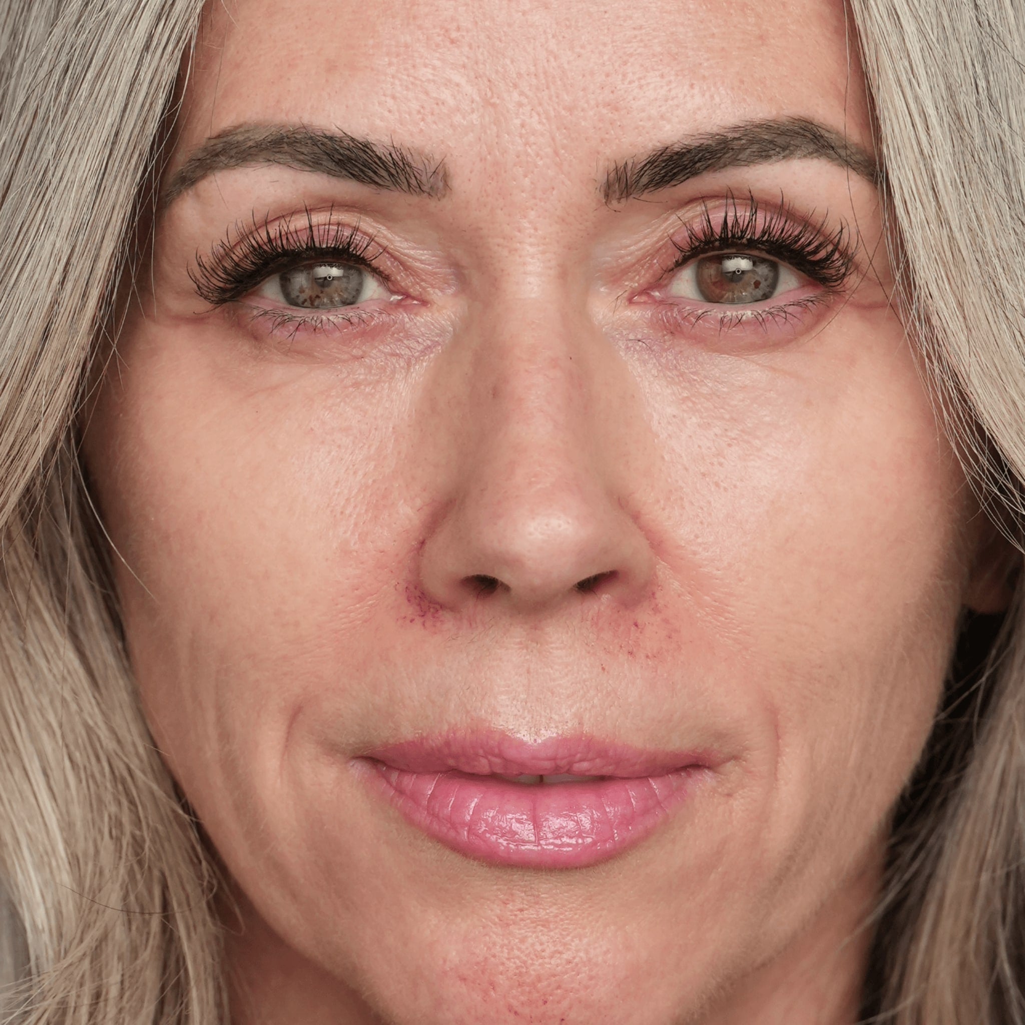 Close up of a woman's face and skin