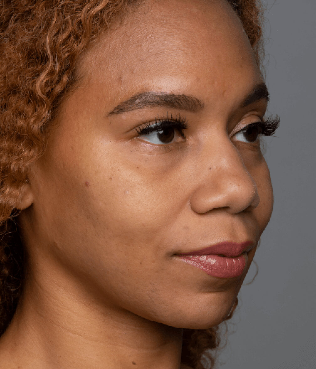 Close up of a woman's face and skin