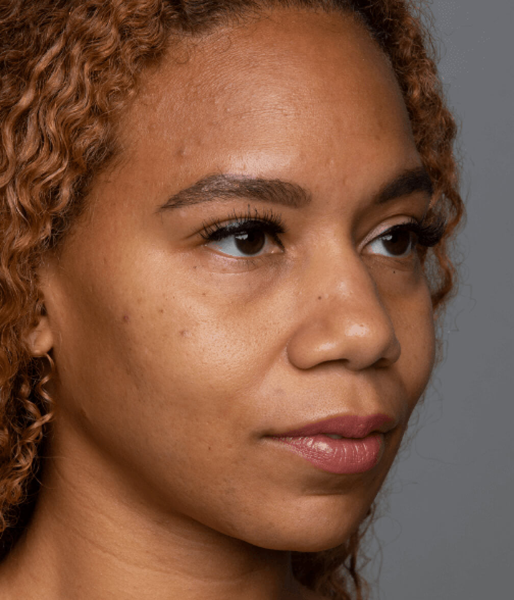 Close up of a woman's face and skin