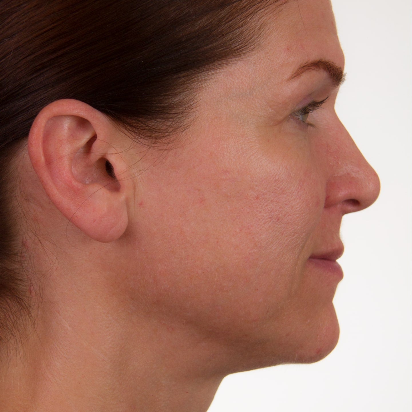Close up photo of a woman's face, showing her side profile