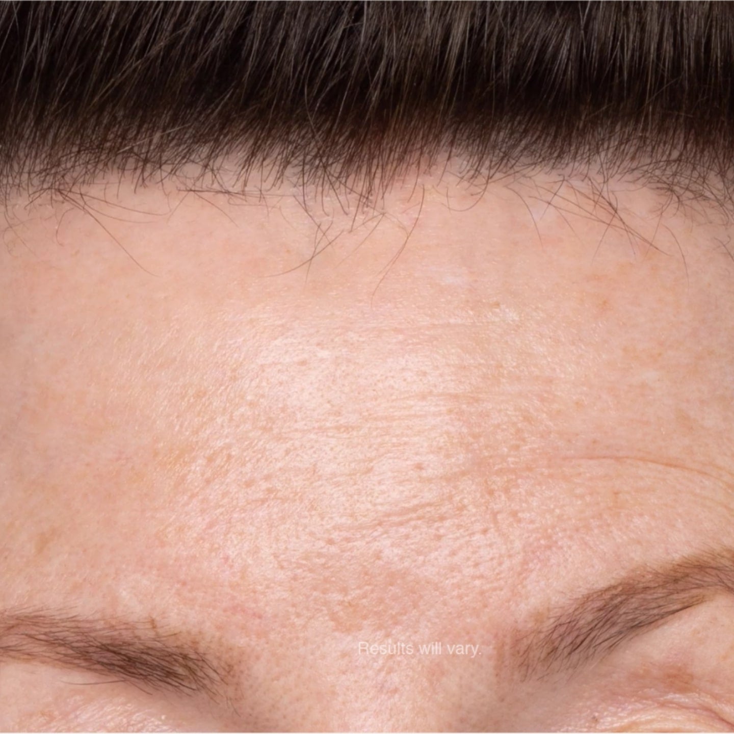 Close up photo of a woman's forehead