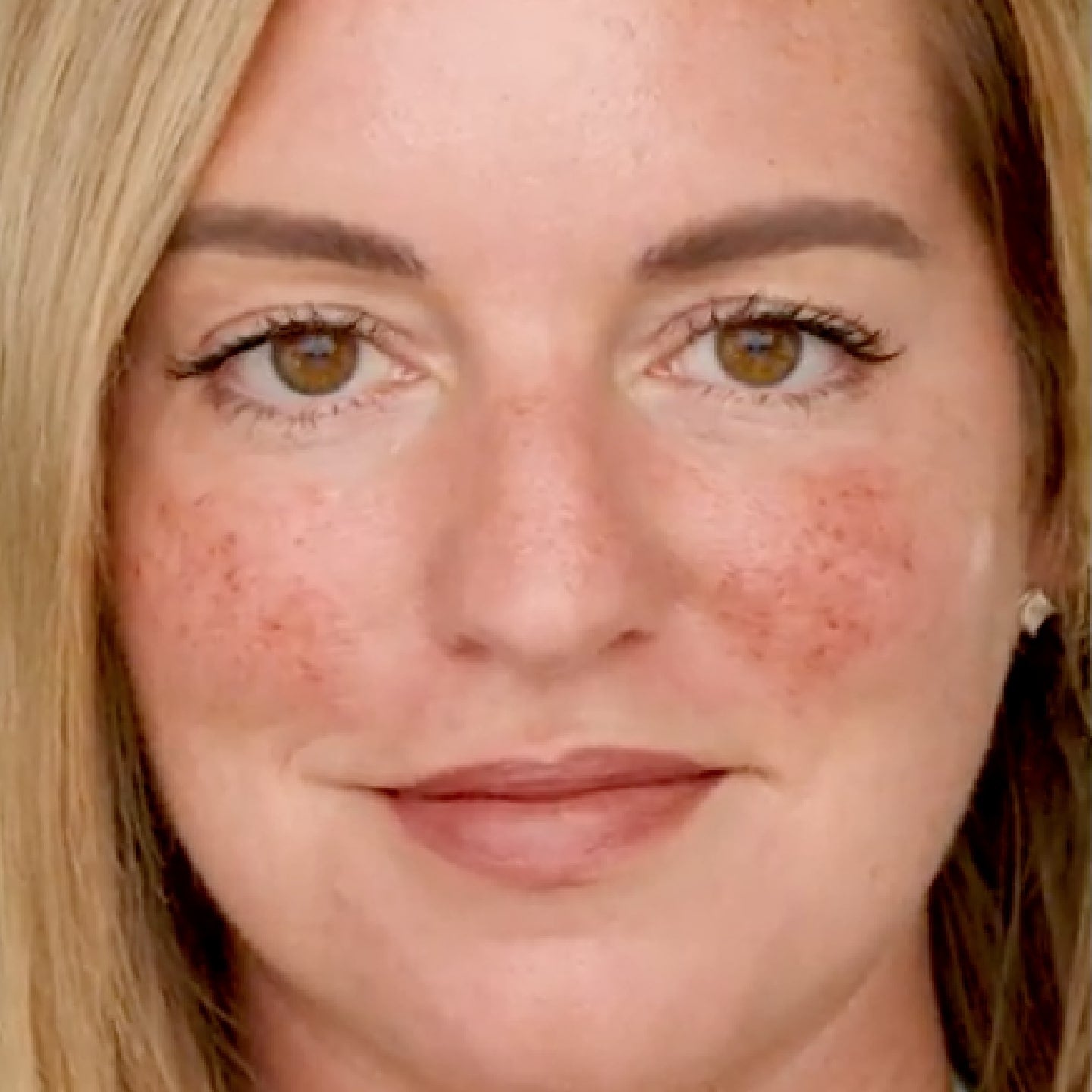 Close up of a woman's face and skin